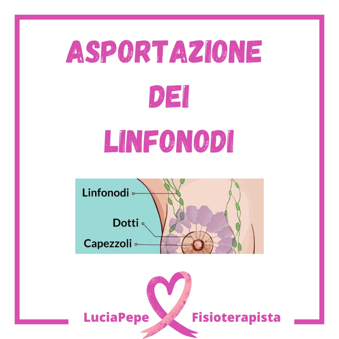 Asportazione dei linfonodi e Linfedema