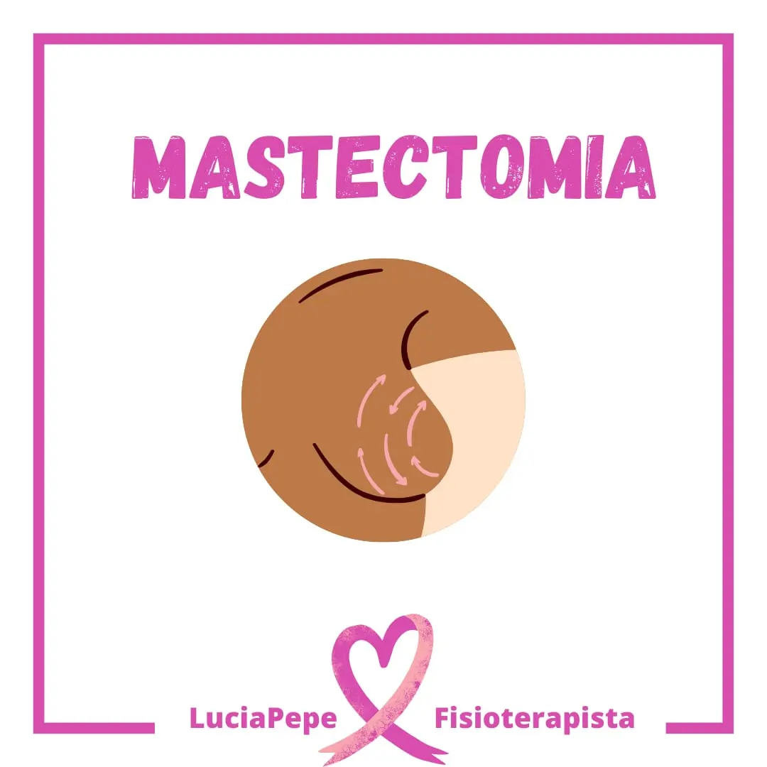 Mastectomia e Linfedema