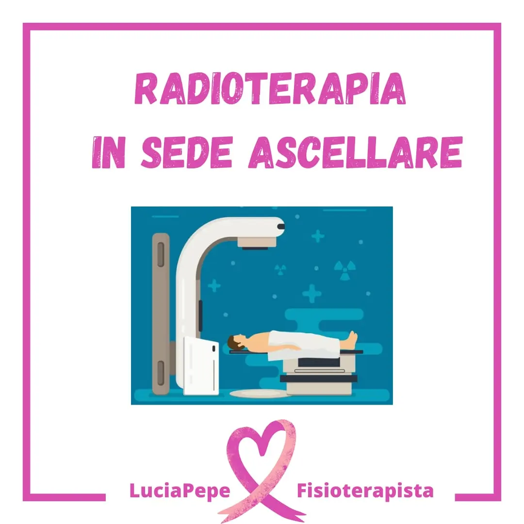 Radioterapia ascellare e Linfedema