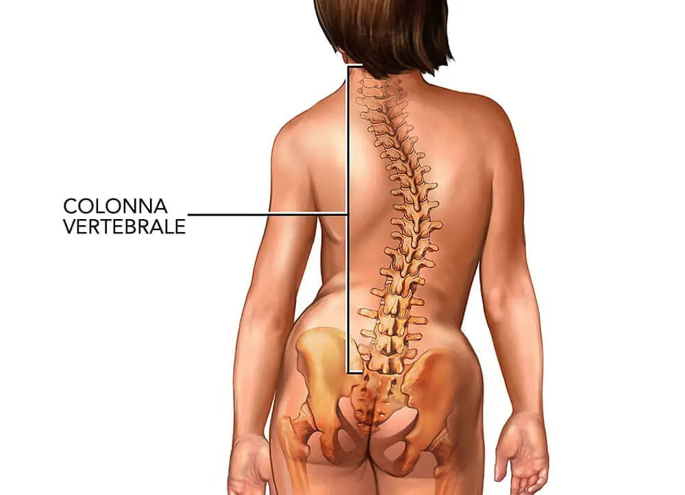 Rieducazione posturale con Metodo Mézières e scoliosi