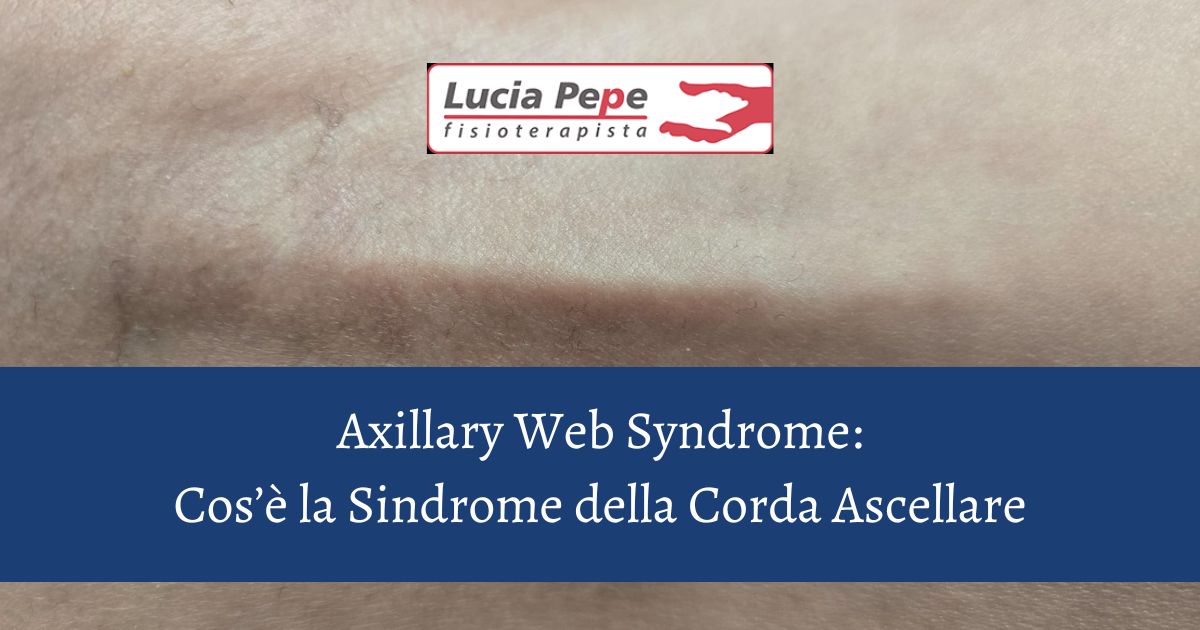 Cosa è la Sindrome della Corda Ascellare?